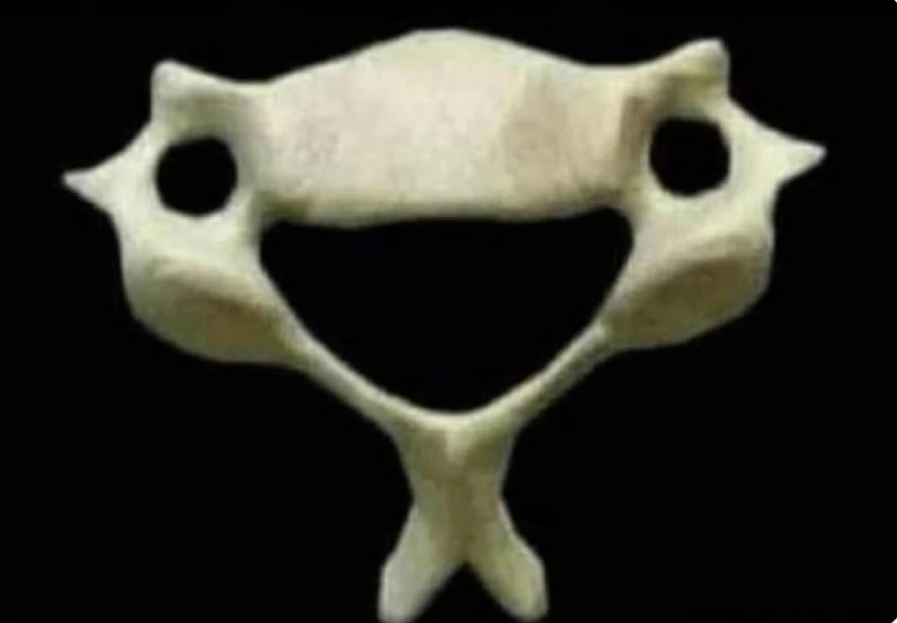 bone