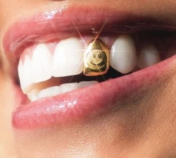 ARCGOLD