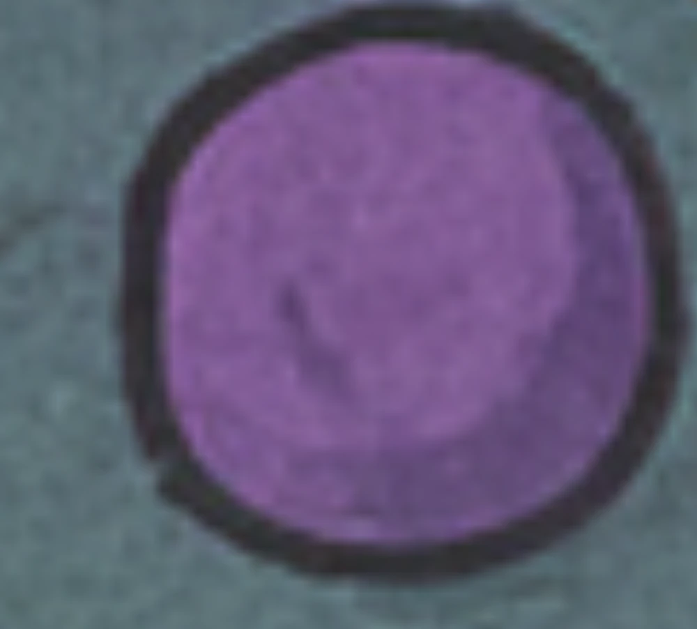 HSDFH